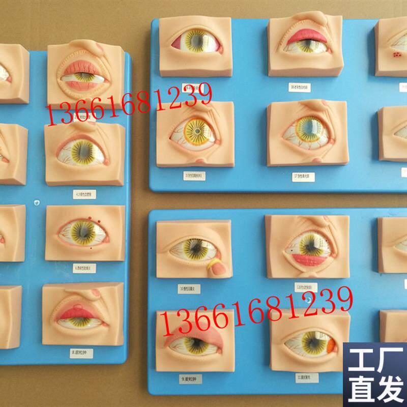 人体常见眼病模型常用眼科疾病模具教学指导病态眼睛示教Y标本20