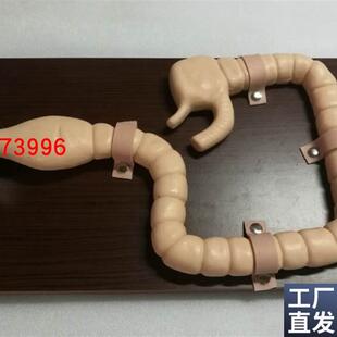乙状结肠镜检查模型大E肠肠道病变检查模型