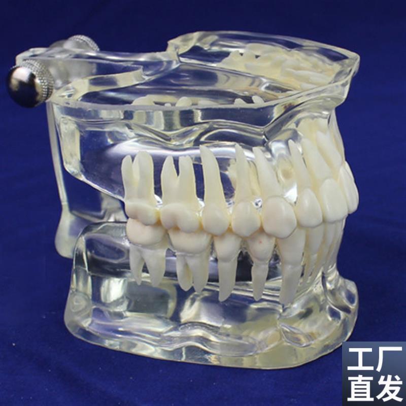 颐诺正品透明成人标准牙齿v模型口腔牙齿科标准牙列模型牙医颌面