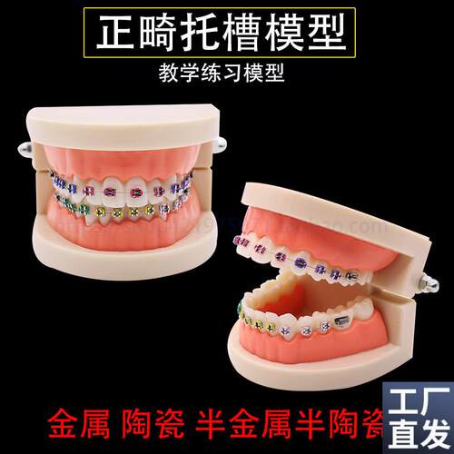 牙科正畸带托槽假牙模型医患沟通教学模型矫正练习X托槽模型包邮