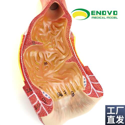 ENOVO颐诺医学人体直肠肛管肛门解剖结构模R型肛肠科外科普外科