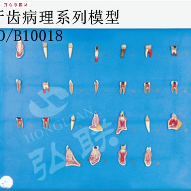 全科医生GD/B10018I牙齿病理系列模型