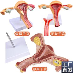 人体模型女性生殖子宫q模型阴道卵巢模型教学模具子宫病理演示模