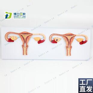 卵子受精过程放大模型q女性卵子受精及卵子发育输送及着床模型