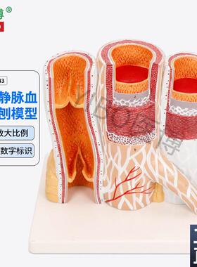 医博BIX-A3443动脉q静脉血管解刨模型人体血管解刨放大模型血管切