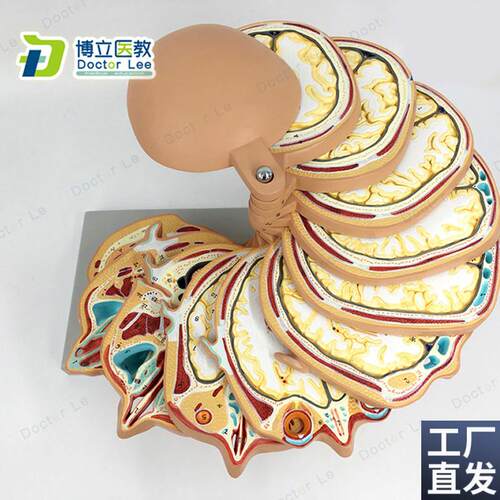 正品人体头部断层头m颅脑水平切模型脑CTMRI大脑模型影像放射学