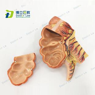 医学回盲部解剖模型盲肠阑尾升D结回肠血管淋巴模型消化系统教