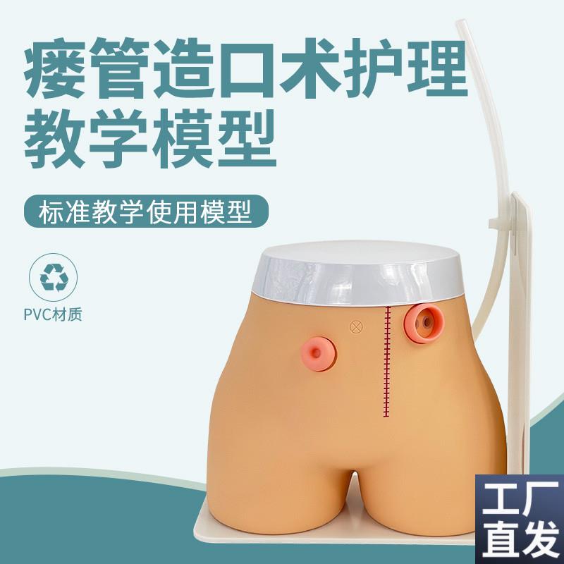 造瘘练习模型结肠造口回肠造瘘D模型高级瘘管造口术护理模型