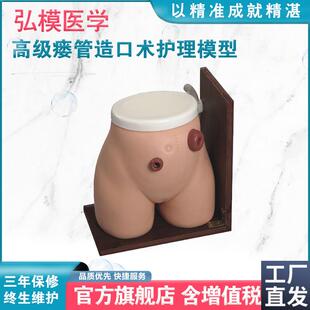 弘模HOM/38高级瘘管造口术护理模型回肠Q造瘘口管饲灌肠练习
