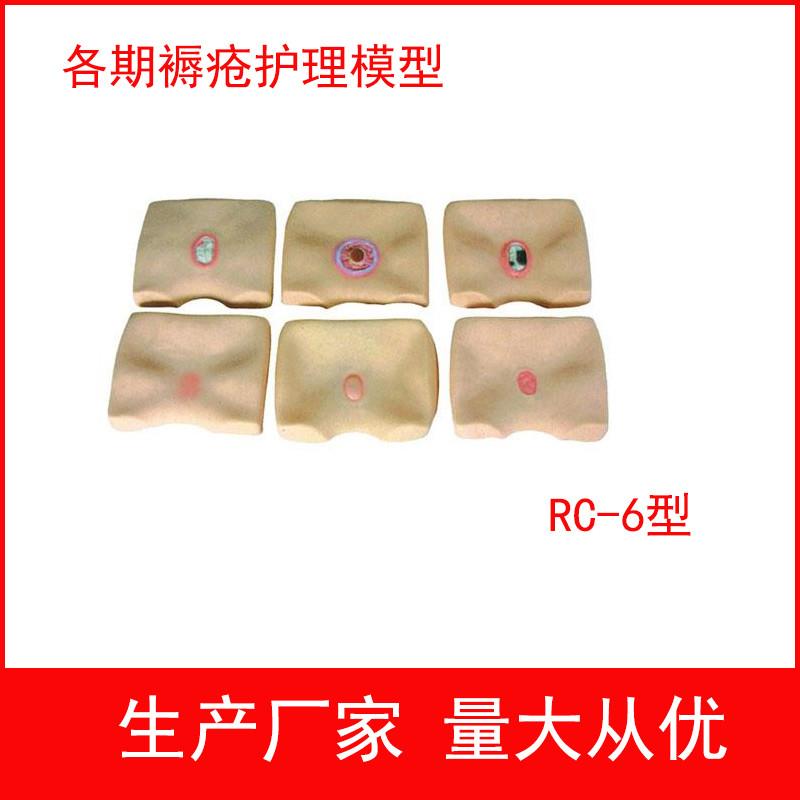 各期褥疮护理模型 四阶段褥疮护理练习模型 褥疮护理训练模型