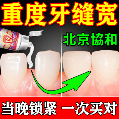 100%修复牙缝宽大专用膏【协和】