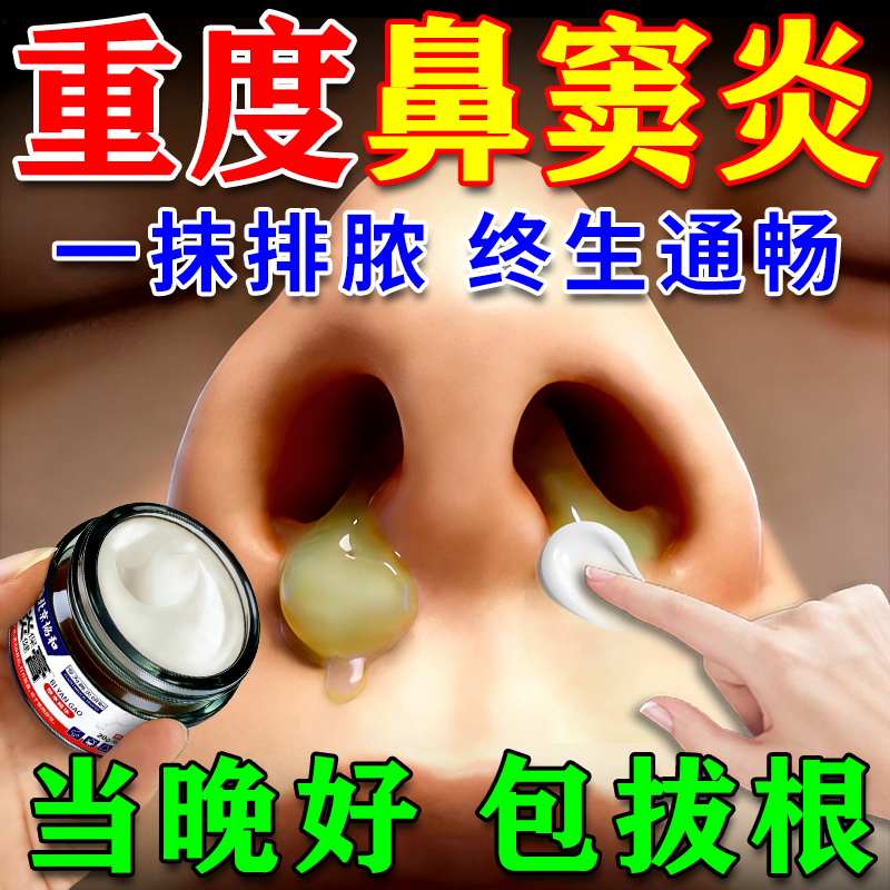 鼻窦炎专用特效膏药根断治疗儿童成人鼻炎排脓鼻塞通鼻神器膏药贴