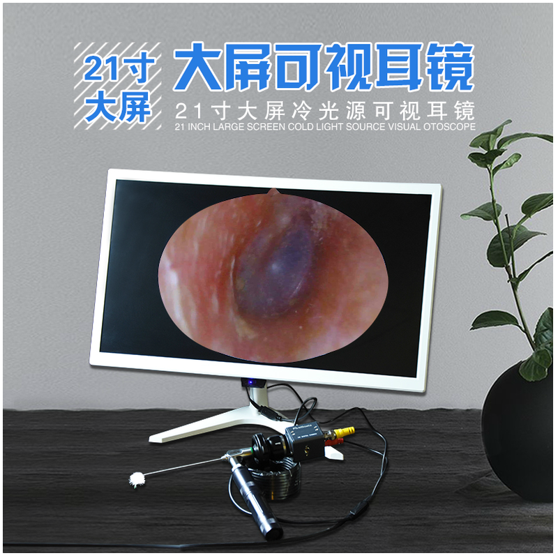 采耳工具专业21寸大屏内窥镜