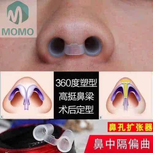 鼻子支架价格 鼻子支架图片 星期三