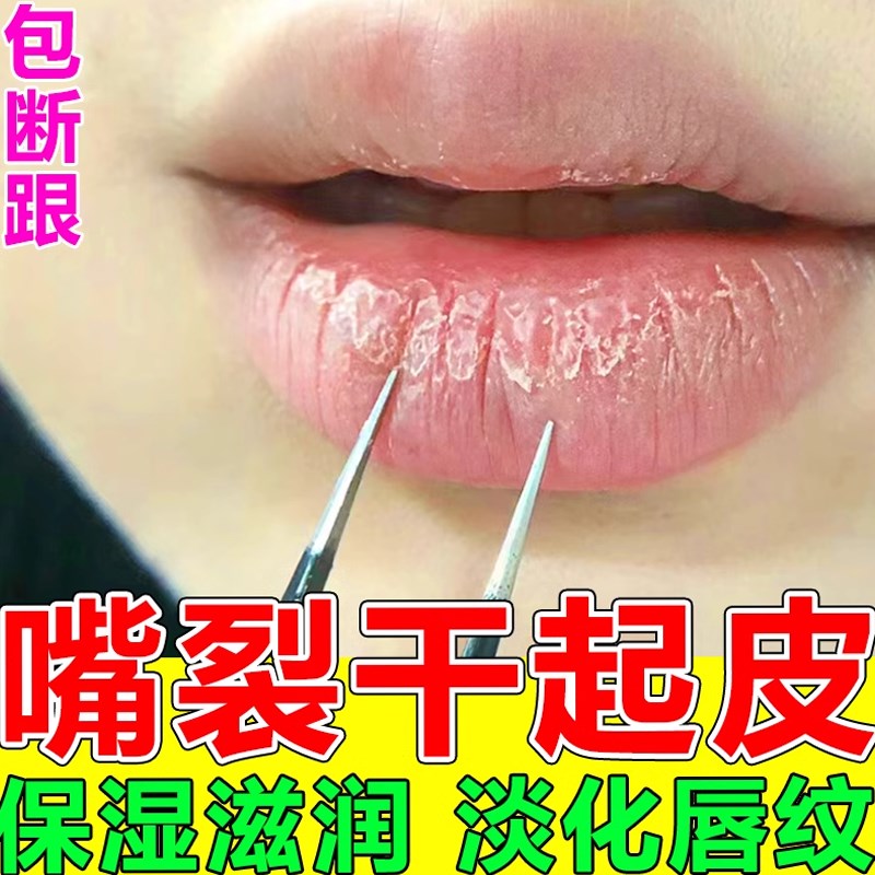 【云南本草唇炎润唇膏】修复干裂起泡脱皮嘴角裂保湿滋润男女