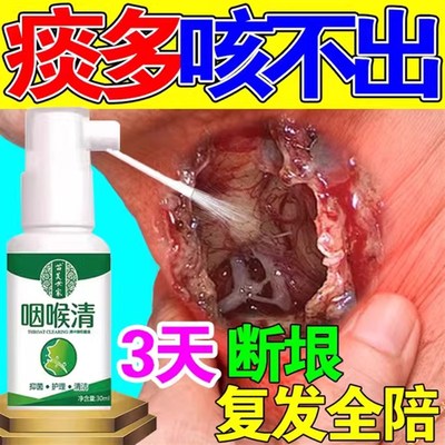 痰多吐不完粘嗓子不舒服老有痰喉咙有异物感干痒咳嗽咽喉清喷雾剂