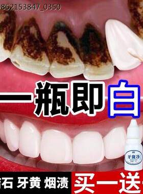 洗牙液水漂白清洁牙齿亮白速效神器强效快速去除黄牙烟渍黑蚜污垢