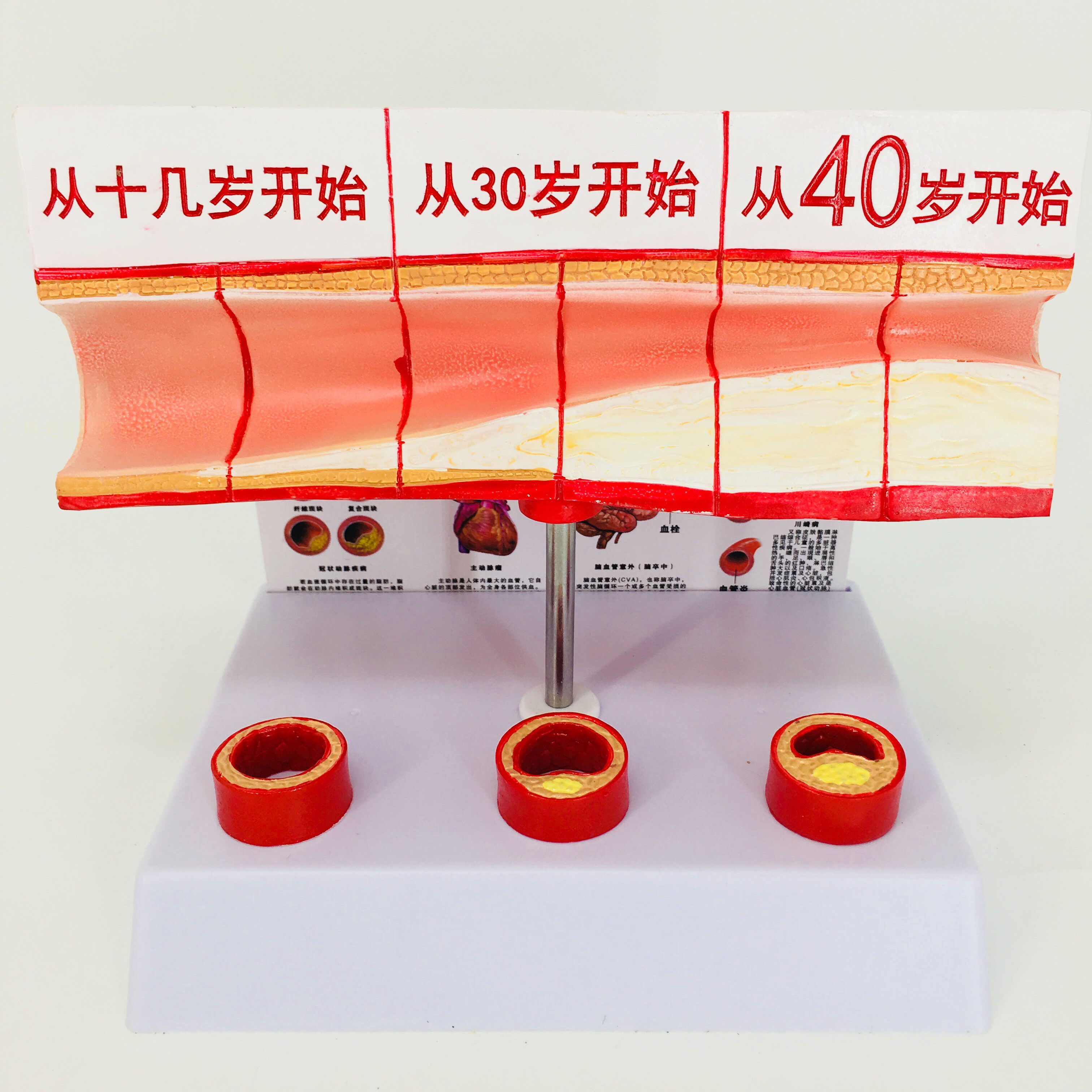 血管人体血管解剖模型各阶段年龄层血管展示模型大型血管展示