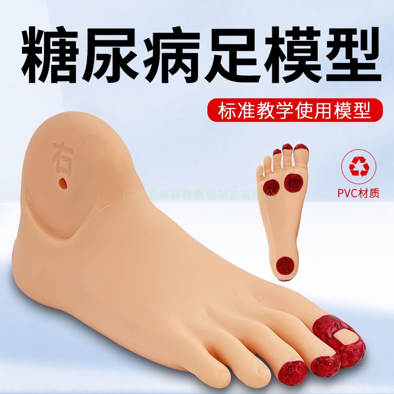 糖尿bing足护理模型 老年人 足部病变护理模型 畸形脚模具