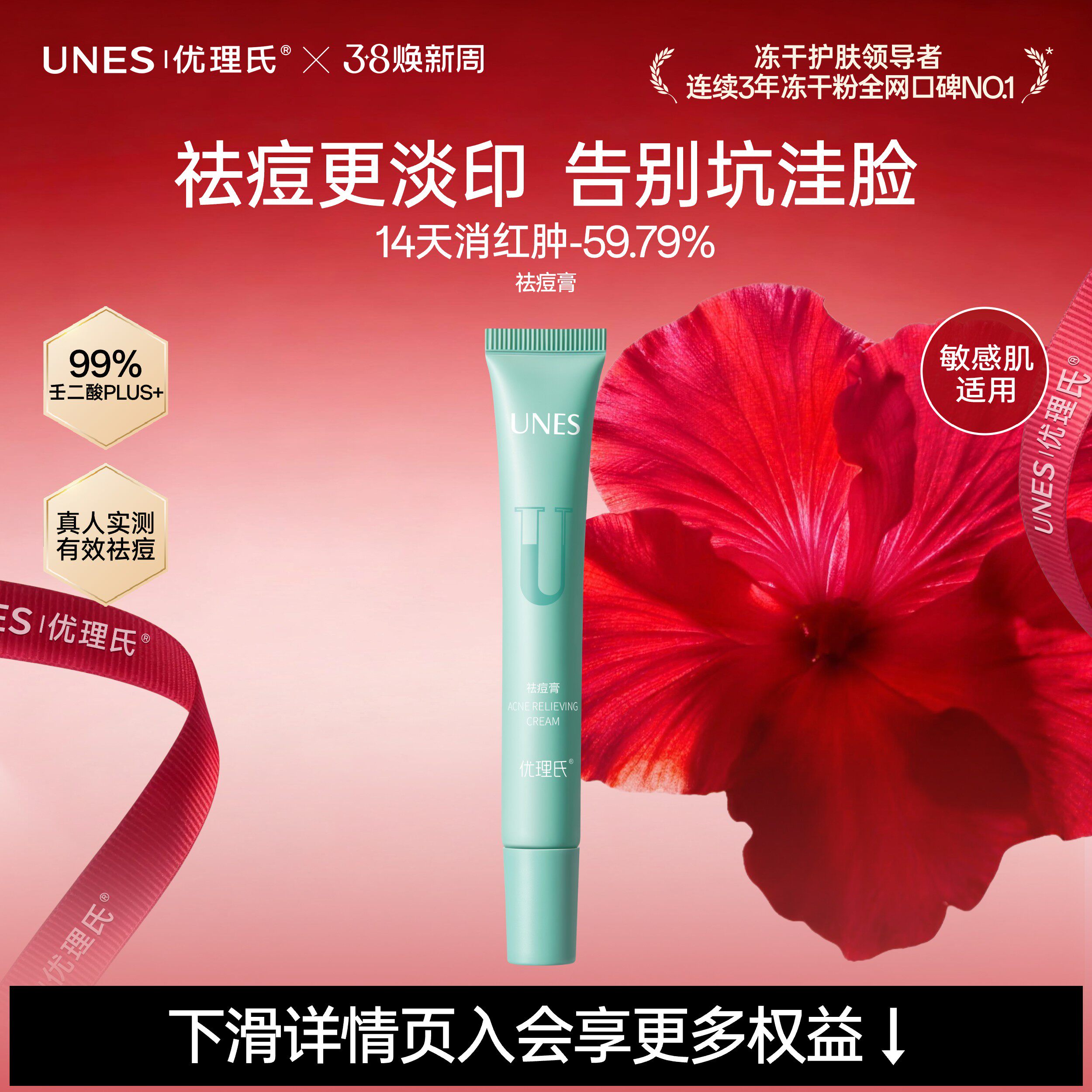 【祛痘消印】优理氏壬二酸祛痘膏祛痘坑淡化修复痘疤痤疮收缩毛孔