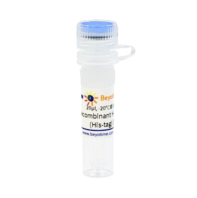 Recombinant Human Ubiquitin (His-tag)  P8001