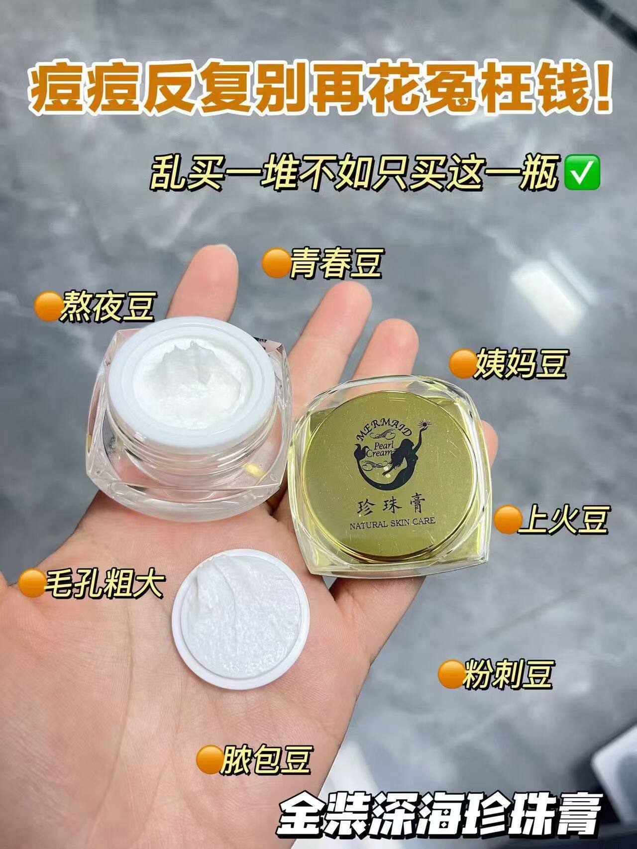金装珍珠膏10g祛痘印粉刺闭口收缩毛孔祛黄提亮肤实体店正品