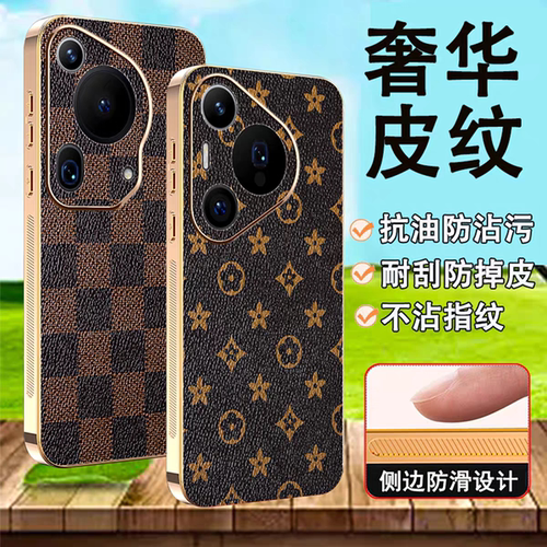 适用荣耀600 500 400 300 200 100 90Pro电镀金边豹纹手机壳Power2格子皮纹X80 70 60 50 40防摔Magic8 7 6 5
