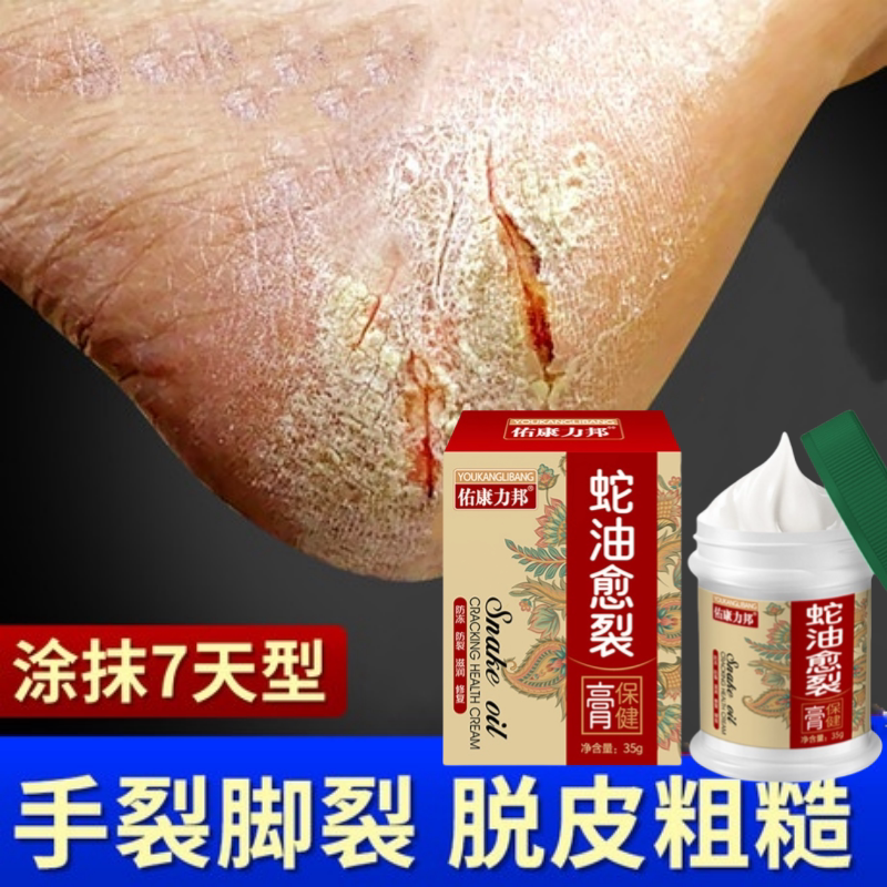 治手脚裂的药膏防干裂
