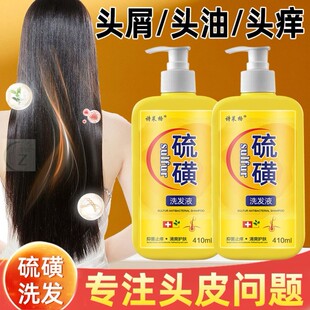 硫磺洗发水去屑止痒头皮毛囊头痒除螨控油10%洗头膏脂溢性头皮痘z