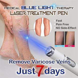 Heath Blue Light Therapy Varicose Ve Treatment Laser Pen Sof