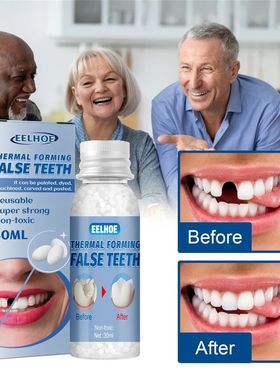 30ml Temporary Tooth Repair Kit Teeth And Gaps FalseTeeth So