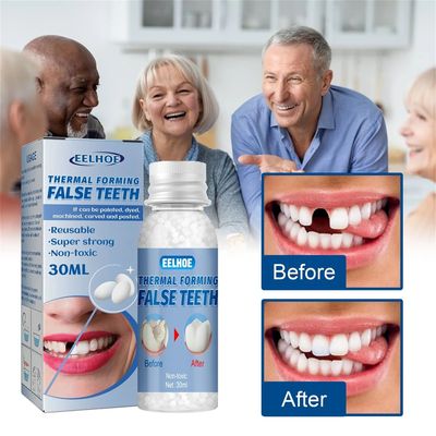 30ml Temporary Tooth Repair Kit Teeth And Gaps FalseTeeth So