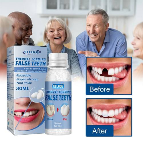 30ml Temporary Tooth Repair Kit Teeth And Gaps FalseTeeth So