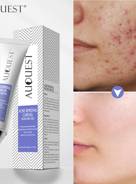 Herbal Acne Treatment Cream Pimple Spot Removal for Teens Oi