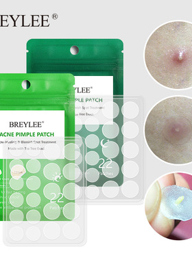 Acne Pimple Patch  Stickers Treatment Pimple Remover 痘痘贴