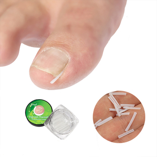 10PCS Silicone Ingrown Nail Pad Relief Pain Paronychia Corre