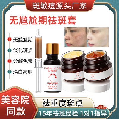 祛斑套无尴尬精华液美白分解黑色素排色液一抹净斑术美容院专用