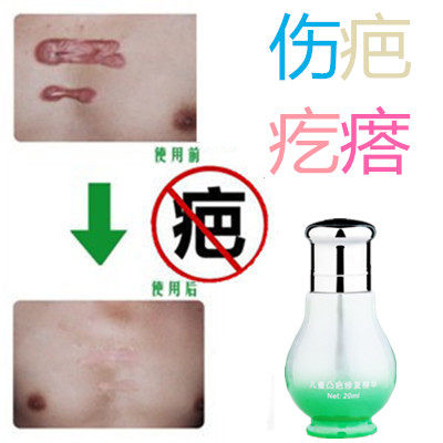 除缝针儿童剖宫产突疤疙瘩破宫产刀伤巴痕烟疤手术抓伤摔伤双眼皮