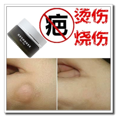 去除刨宫产疤痕体质的贴膏药修复疙瘩凸起精油淡化脸部黑色素沉淀