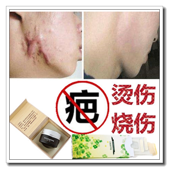 消去增生烫伤疤痕贴日本产祛除肉疙瘩皮肤药膏烧伤抑疤灵敷料正品