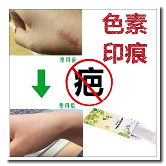 去增生凸起软化膏舒疤坦祛烟烫伤疤痕凝胶分解修复斑冻干粉黑色素