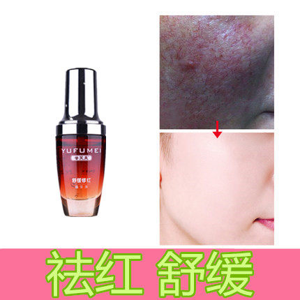 舒缓敏感肌脸部皮肤过敏发红修复增厚角质层去除红血丝正品精华霜