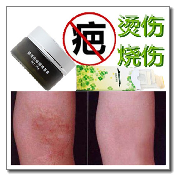 烫伤疤客防水贴去除多年手术缝针疤痕灵膏祛修复烧伤黑色素沉淀霜