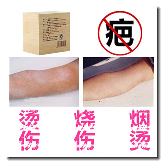 淡化唇纹黑色素伤口缝针巴愈合膏儿童消痘印祛学生痘疤去软化疙瘩