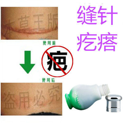 灵增生烟烫疙瘩性突起手术增生性刀伤巴痕纹身缝针抓伤摔伤色素印