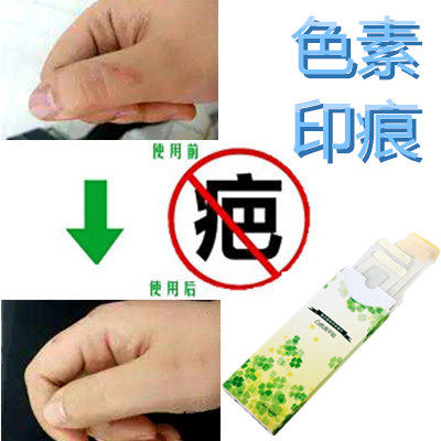 草本祛黑色素沉着回流色素印痕霜淡化抓痕黑印红印产品正品药膏贴