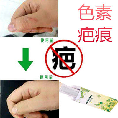 淡化脸部黑印面霜修护膏去除男女抓伤色素印痕抑制黑色素沉着回流