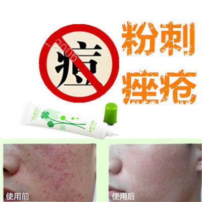 面部精华