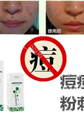 奇迹草本祛前胸封闭合性酒刺青春痘痘去除后背白头粉刺脂肪粒痤疮