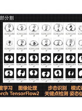 医学图像处理病理检测识别分割对抗生成网络算法项目程序界面制作